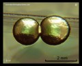 escherichia coli